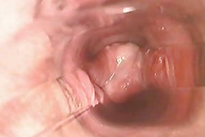 Giovane fatto sesso con magra influenza spagnola